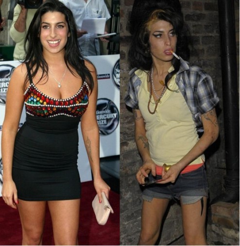 before-and-after-amy-winehouse
